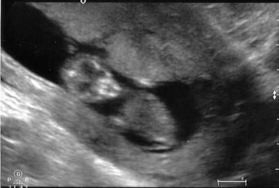 0308/1stTriScan20331.jpg
