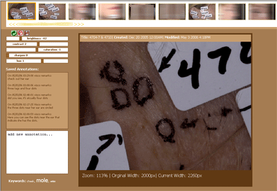 0506/cancerViewer2351.png