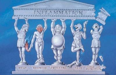 0109/InflammationCartoon0104.jpg