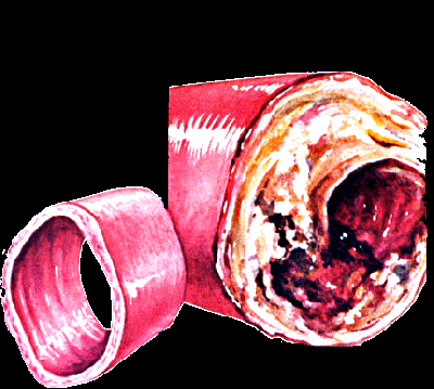 1108/Clog1107.gif